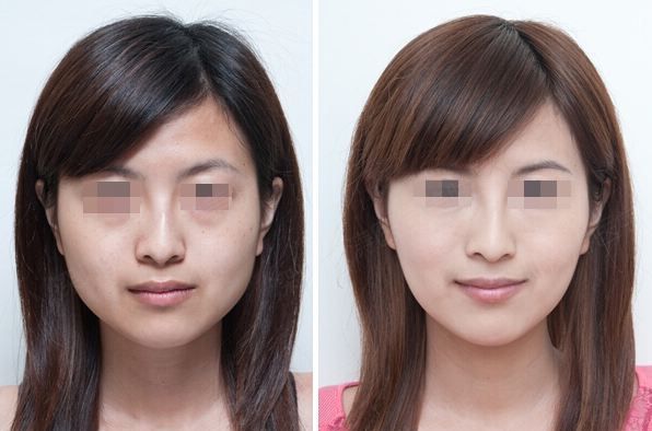 上海哪些醫(yī)院在隆胸技術(shù)領域有出色表現(xiàn)？熟練掌握豐胸技術(shù)的醫(yī)生排行榜