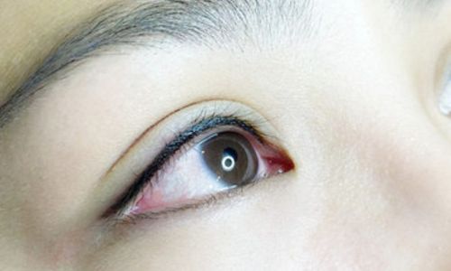 劉中國(guó)醫(yī)生成都潤(rùn)美玉之光整形醫(yī)院的口碑是否好？大腿吸脂術(shù)效果如何呢？