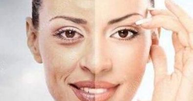 成都賈德淵醫(yī)生的眼睛技術(shù)有何不同？80天變化詳解