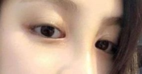如何選擇合適的醫(yī)生，讓你的身材變得完美無暇
