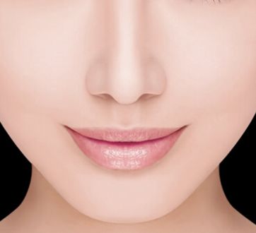 哈醫(yī)大四院李巍主治醫(yī)生鼻整形手術(shù)！80天重塑完美鼻型全記錄！