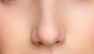 王佳琦雙眼皮修復技術效果如何？醫(yī)生簡介+用戶真實感受，讓您信心倍增！