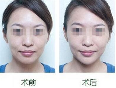 沈陽市的專業(yè)雙眼皮整形醫(yī)院哪家好，排名前三值得信賴