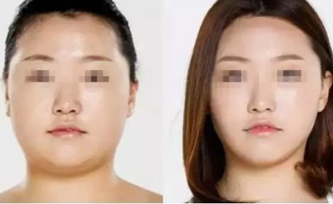 寧波2023年抽脂醫(yī)生排名揭曉！這幾位口碑爆棚的專家堪稱翹楚！