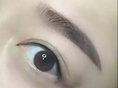 護(hù)眼實(shí)踐：林琦東如何改善視力？真實(shí)案例揭示眼部整形費(fèi)用