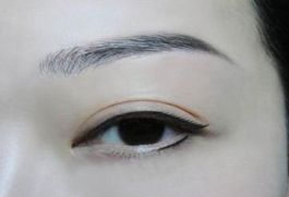 深圳著名眼袋整形專家?guī)湍獯?，鵬程醫(yī)院是否值得選擇？