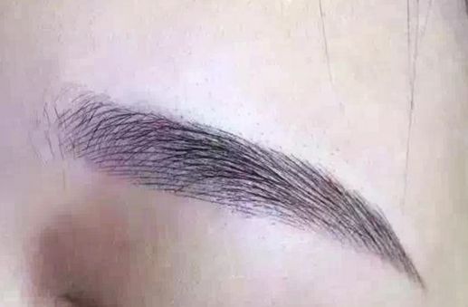 長沙脂肪吸取專家揭秘：技術(shù)卓越，無數(shù)口碑背后的醫(yī)美奇跡！