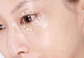 吳毅平醫(yī)生坐診醫(yī)院及隆胸案例分享，詳細介紹！
