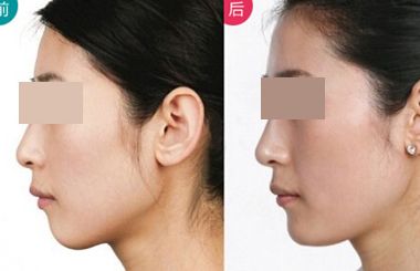 上海哪個(gè)醫(yī)生擅長(zhǎng)鼻翼縮小？2023年度網(wǎng)民口碑推薦醫(yī)生名冊(cè)曝光