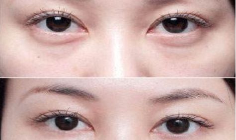 成都眼部整形醫(yī)生高分榜單發(fā)布！這些醫(yī)生哪家強(qiáng)？附詳細(xì)醫(yī)生信息