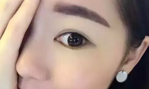 丁世凱教授：看看他的鼻子，醫(yī)生簡(jiǎn)介+案例恢復(fù)過程圖參考