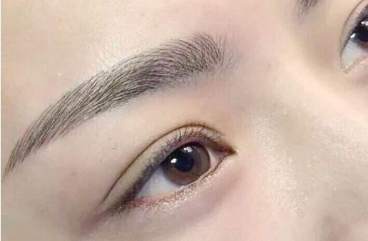 眼袋手術(shù)費(fèi)用及醫(yī)生評價與項目分析？