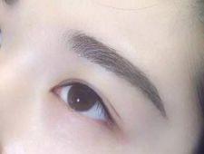 李炳澮醫(yī)生獨(dú)特的技術(shù) 手術(shù)風(fēng)格有何特點(diǎn)？并附帶隆鼻案例分析
