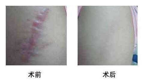 濟(jì)南有哪些人氣更高的美容整形醫(yī)院海峽和旭美如何評(píng)價(jià) 濟(jì)南有哪些人氣更高的美容整形醫(yī)院海峽和旭美如何評(píng)價(jià)