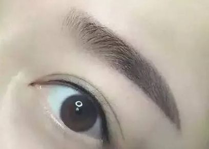 醫(yī)生楊明勇：從技術(shù)實(shí)力到用戶評(píng)價(jià)揭秘，提眉案例評(píng)價(jià)出乎預(yù)料！