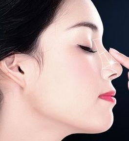 成都哪家醫(yī)院做面部吸脂效果好，口碑公開