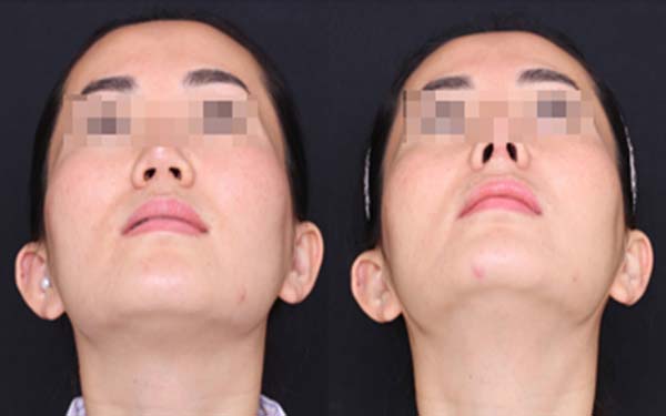 淄博麗人醫(yī)院整形美容科靠譜嗎？有口碑醫(yī)生推薦嗎？
