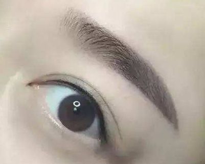 廈門哪家整形醫(yī)院口碑好？專家推薦薇格、中山前三！
