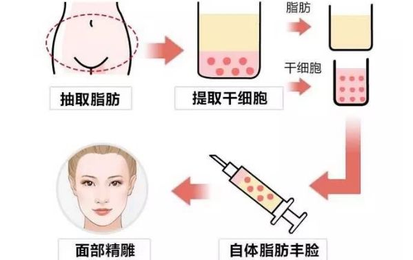 從醫(yī)生個(gè)人資料到豐胸案例圖對比，揭秘王沛森的豐胸效果！