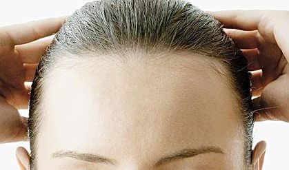 郭建玲雙眼皮修復(fù)費(fèi)用揭秘！看真實(shí)案例圖分享，了解其技術(shù)效果！