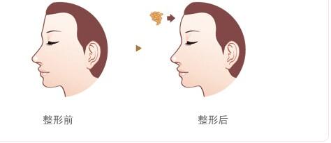 綿陽(yáng)碧蓮盛植發(fā)醫(yī)院的效果如何？如何查詢地址及醫(yī)生信息？