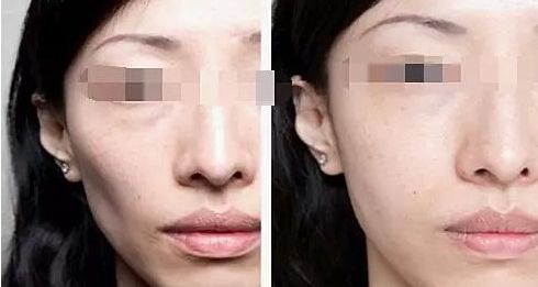廈門整容醫(yī)院實力排名揭曉，輕松擁有美麗容顏！