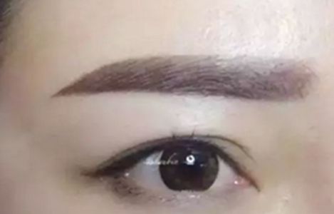 南昌美伊爾醫(yī)院的劉立軍醫(yī)生手術(shù)實力如何？擅長哪些手術(shù)？附真實案例為參考