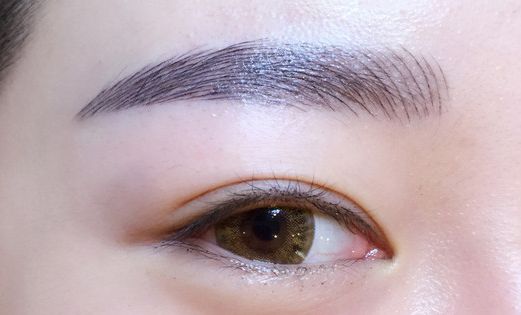 徐利剛：杭州藝星整形臨床實力派！鼻子整形解析，案例詳解！