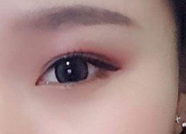 蔣小花醫(yī)生手術(shù)的實際操作方法和評價分享，多樣風(fēng)格消解揭秘！