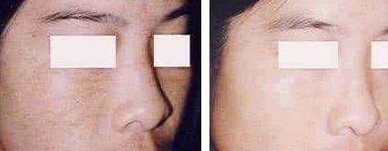 福州美貝爾醫(yī)療美容門診部：薛欣醫(yī)生用戶評價高？真實案例分享！