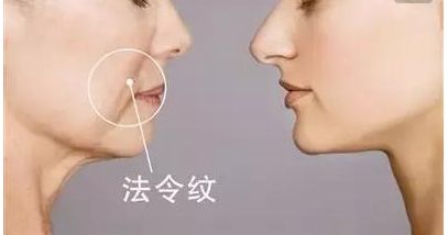韋元強(qiáng)swan吸脂修復(fù)方法介紹，相關(guān)醫(yī)院推薦