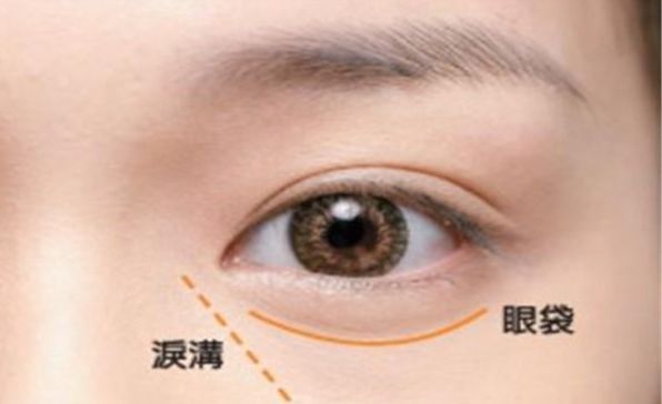 深圳哪家醫(yī)院割雙眼皮技術(shù)獨(dú)步全球？高水平專家團(tuán)隊(duì)助力