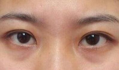 杭州東方整形吸脂到底值不值得嘗試？