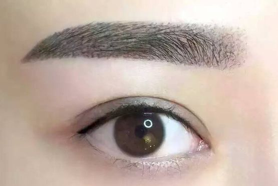 徐州二院美容科雙眼皮手術(shù)陶常波醫(yī)生介紹及成功案例分析 徐州二院美容科雙眼皮手術(shù)陶常波醫(yī)生介紹及成功案例分析