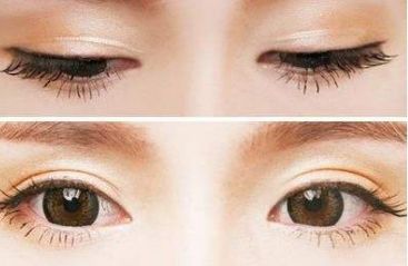 青島壹美天成整形醫(yī)院的隆鼻技術(shù)如何？看看這些真實(shí)案例！