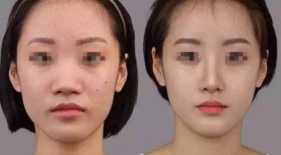韓國(guó)整形醫(yī)院排行榜公布，精選知名品牌推薦