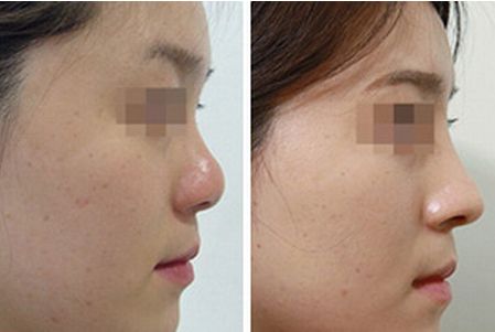 德陽有哪些靠譜的去妊娠紋的醫(yī)院？