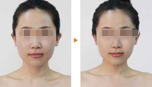 廣州哪家整形醫(yī)院好？排名前十值得推薦