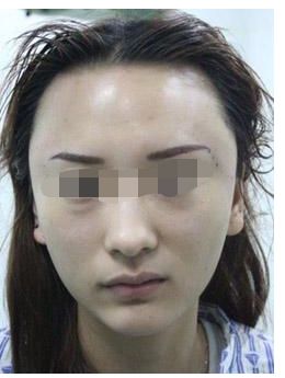 浙江地區(qū)有哪些知名鼻部整形私立醫(yī)院？