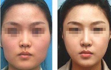 南通瘦身整形醫(yī)院哪家專業(yè)？
