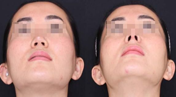 蘭州經(jīng)驗豐富的脂肪豐胸醫(yī)生推薦：逯巖、郭曉磊、雷蓓