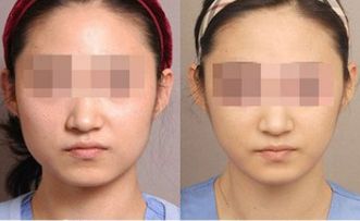 湛江有哪些頂尖整形美容醫(yī)院值得關(guān)注？