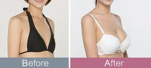 東莞哪家整形醫(yī)院頗受推薦？