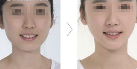 哪家醫(yī)院在北京具有卓越的醫(yī)美科技和服務？歐洲醫(yī)學中心、北京協和、北大人民醫(yī)院等公立單位有何特色？