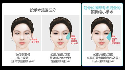 成都康橋眼科醫(yī)院美容科的評價及價格費用推薦 成都康橋眼科醫(yī)院美容科的評價及價格費用推薦
