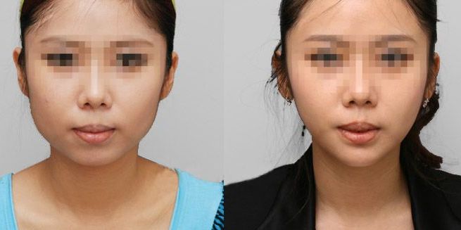 蘭州哪家整形醫(yī)院口碑好？看看排名榜單！
