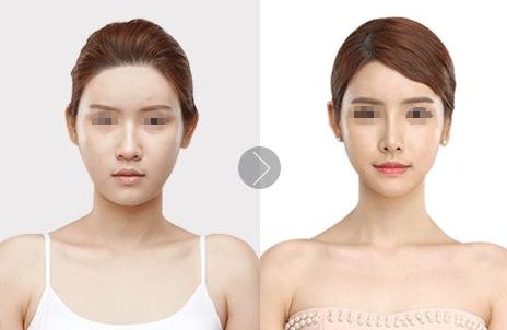 重慶聯(lián)合麗格整形實力解析：雙眼皮、隆鼻、隆胸技術(shù)優(yōu)異，收費透明