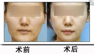 北京醫(yī)院2024年磨骨治療醫(yī)院盤點(diǎn) 北京醫(yī)院2024年磨骨治療醫(yī)院盤點(diǎn)