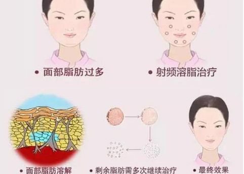 徐州二院整形美容科專家評價及服務(wù)項目介紹，陶常波醫(yī)生特長領(lǐng)域一覽