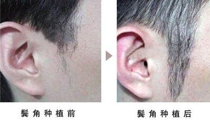 熱瑪吉第四代和第五代差異及價格指南 熱瑪吉第四代和第五代差異及價格指南